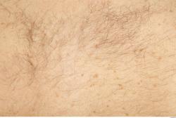 Photo Textures of Human Skin